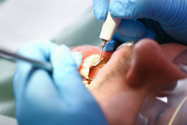 Best Emergency Root Canal Treatment in Camp Croft, SC