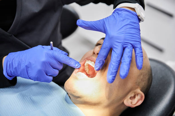 Best Emergency Wisdom Teeth Removal in Camp Croft, SC