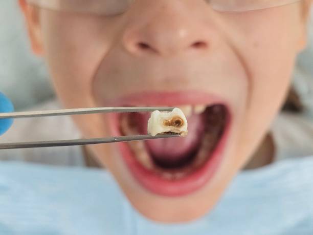 Best Walk-In Emergency Dentist in Camp Croft, SC